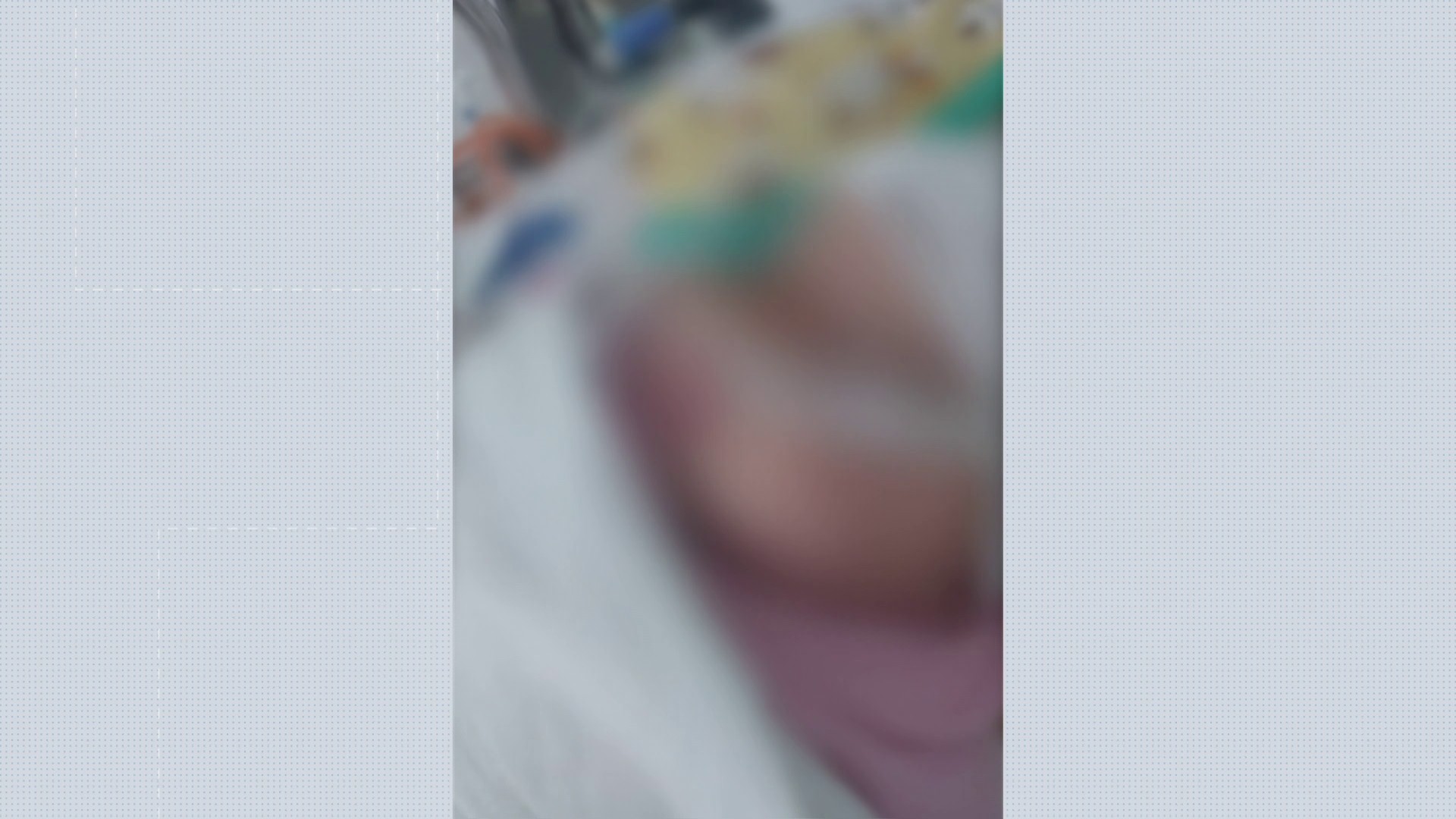 Exames apontam que objeto foi deixado dentro de pulmão de bebê de 3 meses durante processo de intubação em Sergipe